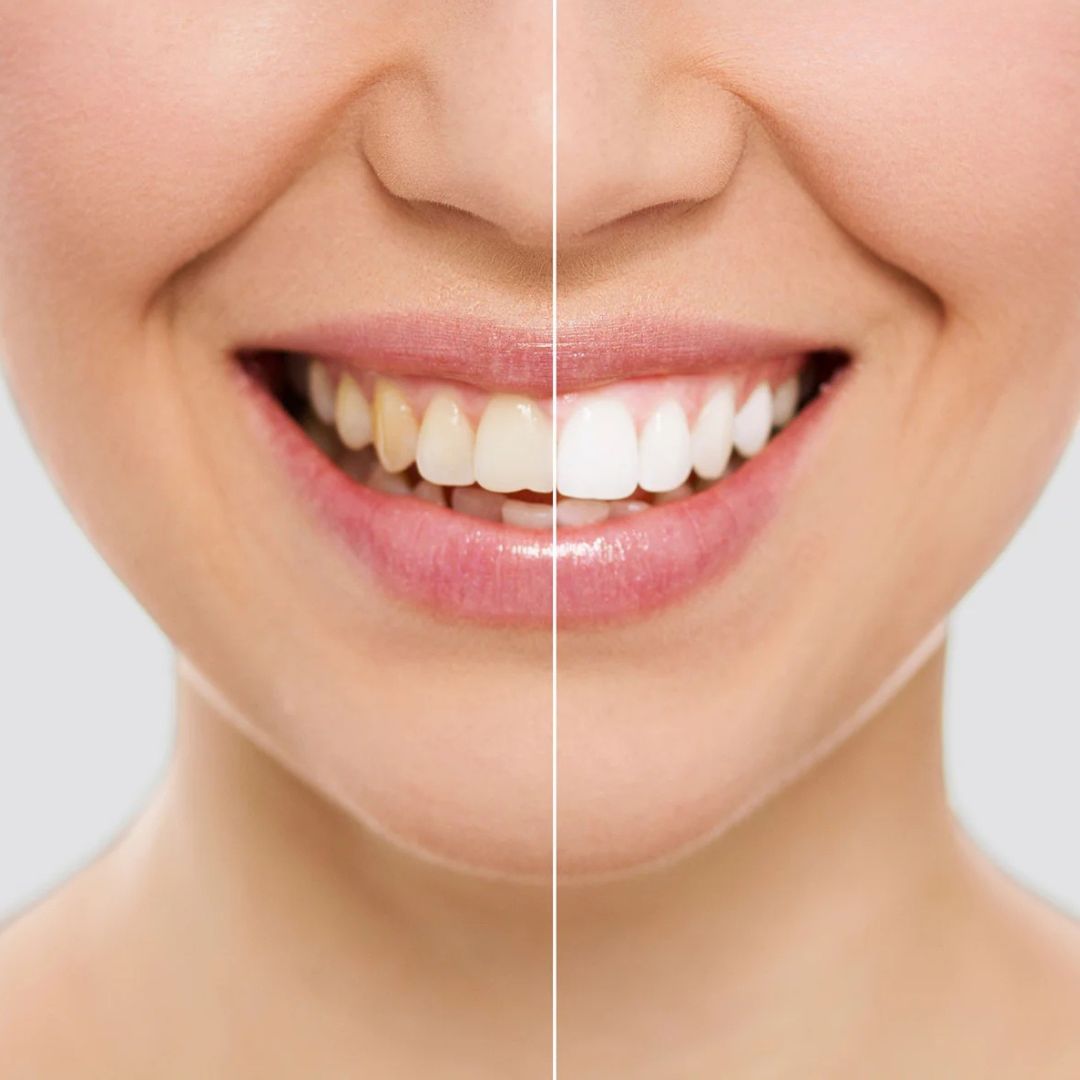 Lápiz Smile White + regalo exclusivo