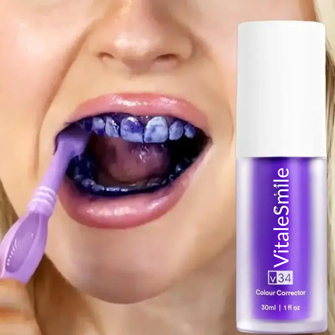 VITALSMILE TEETH WHITENING
